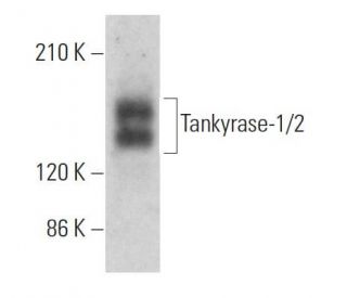 Tankyrase-1/2 Antibody (E-10) - Western Blotting - Image 359672Each CRISPR/Cas9 Knockout (KO) Plasmid product consists of a pool of 3 plasmids designed to ensure identification and cleavage of a specific gene for maximum knockout efficiency. Each plasmid encodes a unique 20 nt sequence derived from the GeCKO (v2) library.