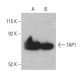 TAP1 Antibody (D-11) - Western Blotting - Image 397375