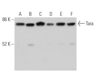 Tara Antibody (G-9) - Western Blotting - Image 367682 