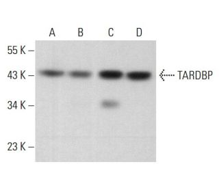 TARDBP Antibody (H-8) - Western Blotting - Image 380716 