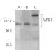 TARSH Antibody (H-8) - Western Blotting - Image 368984