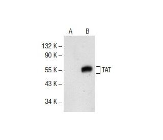 TAT Antibody (D-9) - Western Blotting - Image 141773 