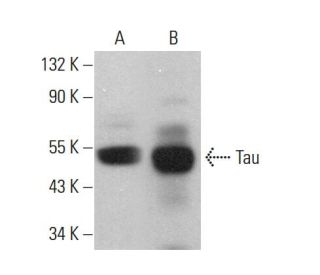 Tau Antibody (Tau 46) - Western Blotting - Image 380253