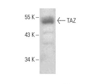 TAZ Antibody (D-8) - Western Blotting - Image 389131The Double Nickase Plasmid features a U6 promoter for sgRNA expression, a 20 nt targeting sequence, and a gRNA scaffold to guide Cas9n. It includes a CBh promoter for Cas9n (D10A) and puromycin resistance, GFP for transfection verification, and nuclear localization signals (NLS). The 2A peptide allows co-expression of Cas9n and Puro from a single promoter, enabling precise genome editing with reduced off-target effects.