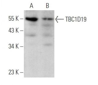 TBC1D19 Antibody (B-6) - Western Blotting - Image 369865 