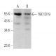 TBC1D19 Antibody (B-6) - Western Blotting - Image 369865 