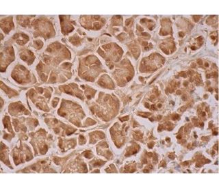 TBC1D19 Antibody (E-6) - Immunohistochemistry - Image 293441 