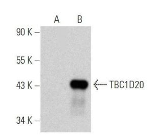 TBC1D20 Antibody (F-9) - Western Blotting - Image 358540