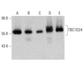 TBC1D24 Antibody (B-4) - Western Blotting - Image 386868 