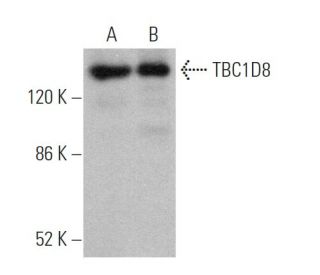 TBC1D8 Antibody (B-5) - Western Blotting - Image 368391 