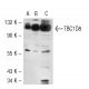 TBC1D8 Antibody (SS-18) - Western Blotting - Image 50612 