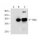 TBCC Antibody (H-5) - Western Blotting - Image 151655 