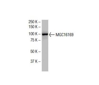TBCK Antibody (WW-8) - Western Blotting - Image 33513 