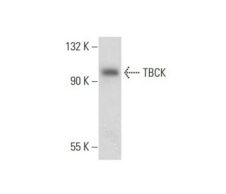TBCK Antibody (WW-8) - Western Blotting - Image 130713 
