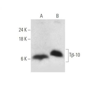 T&beta;-10 Antibody (D-6) - Western Blotting - Image 319567