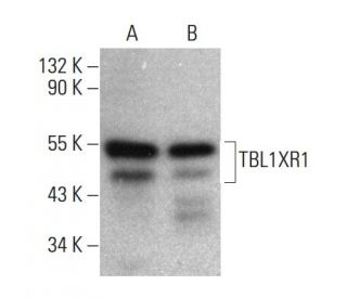 TBL1XR1 Antibody (AP-86) - Western Blotting - Image 384039