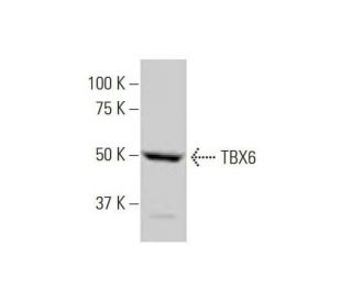 TBX6 Antibody (1D11) - Western Blotting - Image 352145 