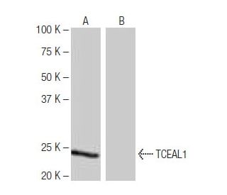 TCEAL1 Antibody (SS-M5) - Western Blotting - Image 65070