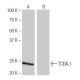 TCEAL1 Antibody (SS-M5) - Western Blotting - Image 65070
