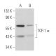 TCP-1 α Antibody (4E215) - Western Blotting - Image 368400