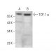 TCP-1 α Antibody (4E215) - Western Blotting - Image 381106 
