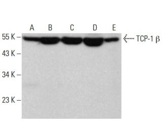 TCP-1 &beta; Antibody (D-8) - Western Blotting - Image 381843 
