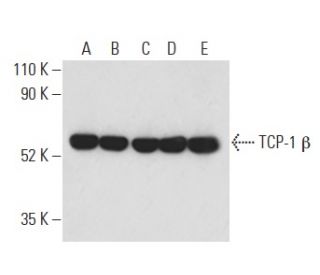 TCP-1 &beta; Antibody (F39 P7 F11) - Western Blotting - Image 399152 