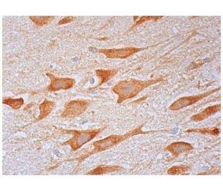 TCP-1 &theta; Antibody (E-1) - Immunohistochemistry - Image 298194 