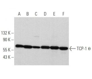 TCP-1 &theta; Antibody (E-7) - Western Blotting - Image 367403 