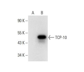 TCP-10 Antibody (E-6) - Western Blotting - Image 308367 