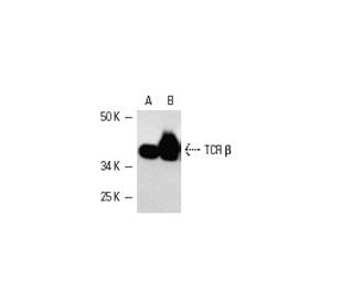 TCR &beta; Antibody (G-11) - Western Blotting - Image 4998 