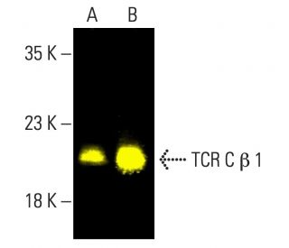 TCR C &beta; 1 Antibody (JOVI.1) - Western Blotting - Image 403281 