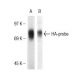 TCR V β 8.1-2 Antibody (KJ16) - Western Blotting - Image 38339 