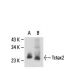 Tctex2 Antibody (H-5) - Western Blotting - Image 18299