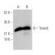 Tctex5 Antibody (D-9) - Western Blotting - Image 372060 