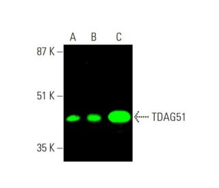 TDAG51 Antibody (RN-6E2) - Western Blotting - Image 381633 