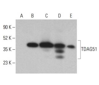TDAG51 Antibody (RN-6E2) - Western Blotting - Image 401206 