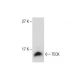 TECK Antibody (YY05) - Western Blotting - Image 287568 