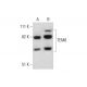 TEM8 Antibody (4H261) - Western Blotting - Image 290039 