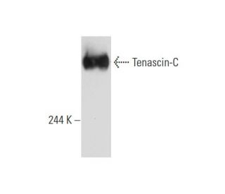 Tenascin-C Antibody (300-3) - Western Blotting - Image 129500Each CRISPR/Cas9 Knockout (KO) Plasmid product consists of a pool of 3 plasmids designed to ensure identification and cleavage of a specific gene for maximum knockout efficiency. Each plasmid encodes a unique 20 nt sequence derived from the GeCKO (v2) library.