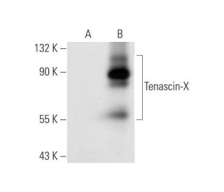 Tenascin-X Antibody (H-10) - Western Blotting - Image 81079