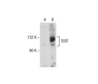 TERT Antibody (C-12) - Western Blotting - Image 157579 
