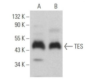 TES Antibody (G-9) - Western Blotting - Image 371542 