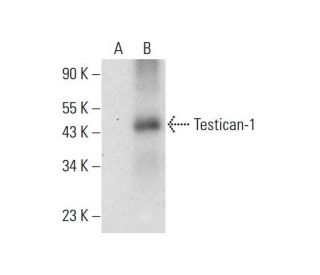 Testican-1 Antibody (A-3) - Western Blotting - Image 308422 