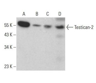 Testican-2 Antibody (B-5) - Western Blotting - Image 379050 
