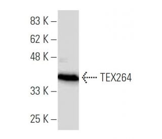 TEX264 Antibody (137.1) - Western Blotting - Image 34315Each CRISPR/Cas9 Knockout (KO) Plasmid product consists of a pool of 3 plasmids designed to ensure identification and cleavage of a specific gene for maximum knockout efficiency. Each plasmid encodes a unique 20 nt sequence derived from the GeCKO (v2) library. 