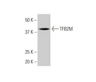 TFB2M Antibody (2E10) - Western Blotting - Image 352214 