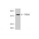 TFB2M Antibody (2E10) - Western Blotting - Image 352214 