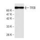 TFEB Antibody (17) - Western Blotting - Image 136747 