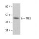 TFEB Antibody (17) - Western Blotting - Image 381430